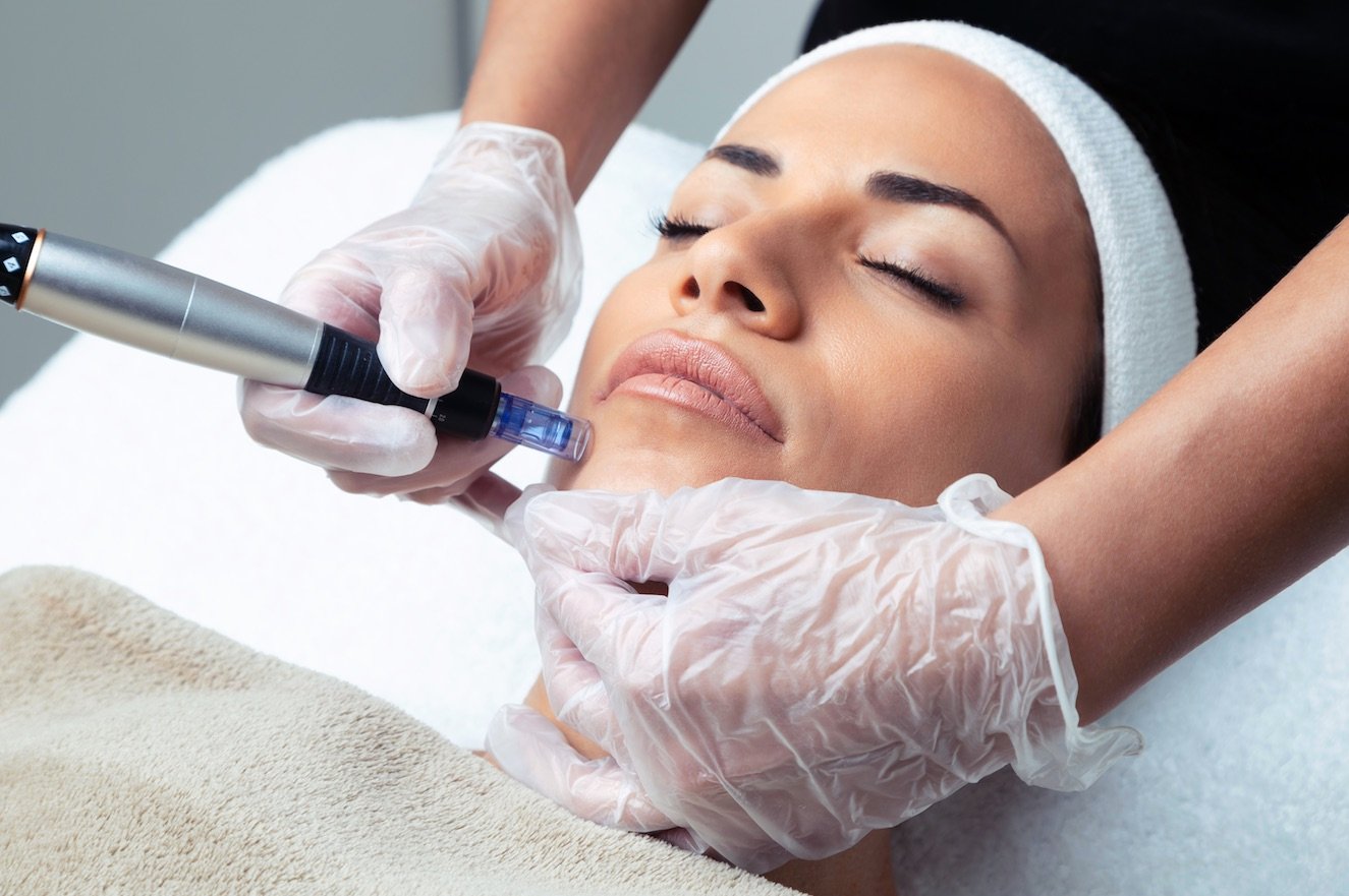 Mesotherapy treatment Mesotherapy treatment